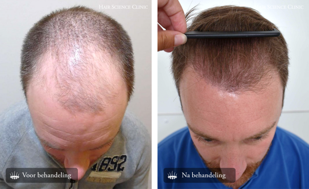 hair science clinic die klinik fur